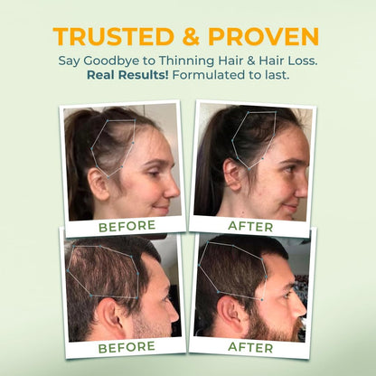 [Vitaf Nutritive Site]Vital Hair Complex Hair Growth Vitamins